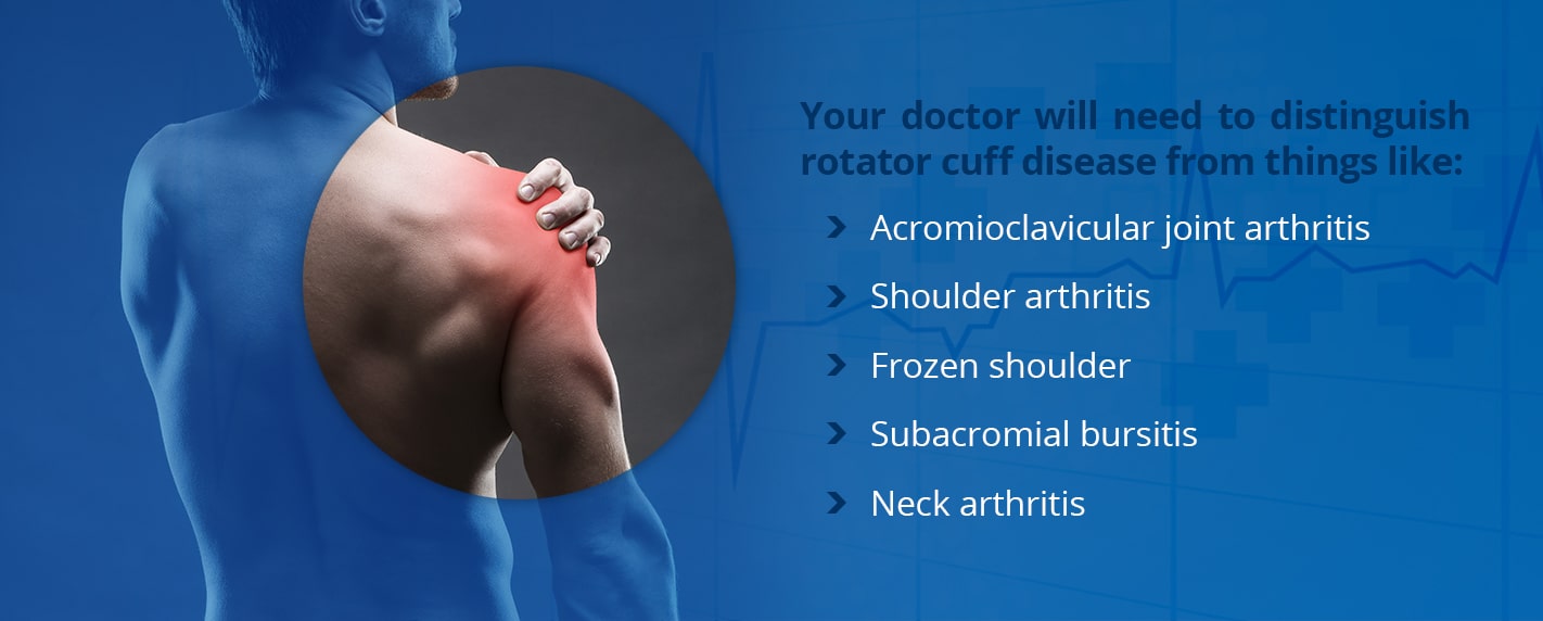 Diagnosis of shoulder pain