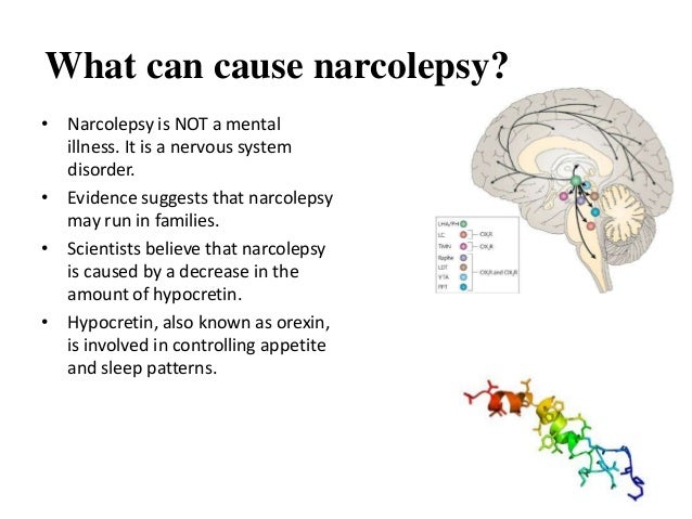 What can cause narcolepsy