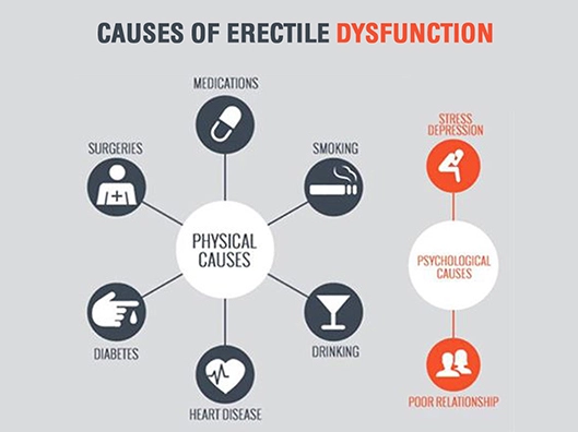 Causes of erectile dysfunction