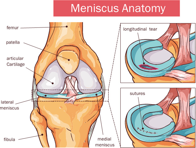 Causes of lateral knee pain