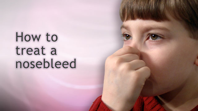 How to treat nosebleeds