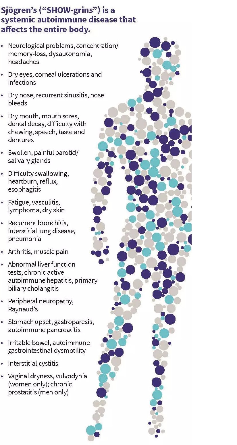 Sjogren's syndrome symptoms