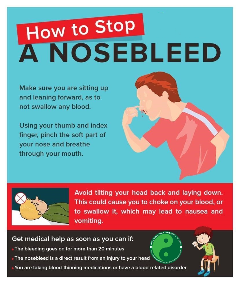 Stop Nosebleed
