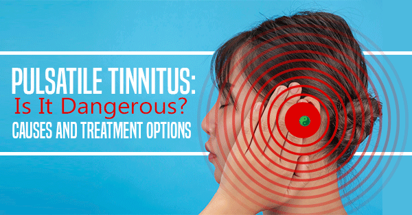 Pulsatile Tinnitus