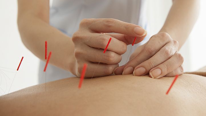 Crohn's disease acupuncture