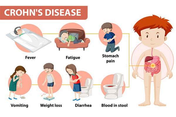 Inflamatory Bowel Disease symptoms