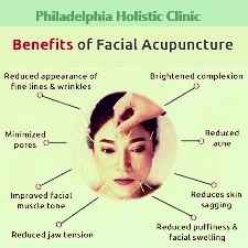 Benefits of facial acupuncture