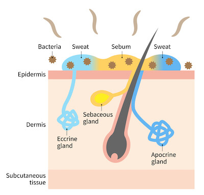 Microbial Origins of bad body smell