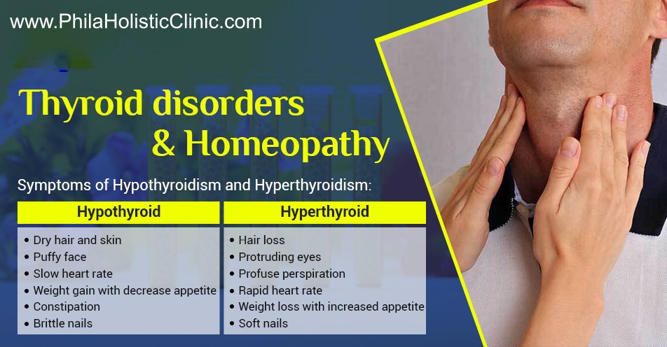 Homeopathy: natural treatment for hyperthyroidism
