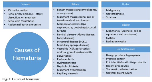 Causes of blood in urine