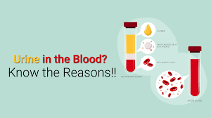 Causes of hematuria