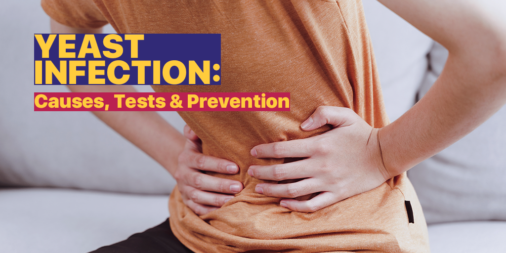 Yeast infection - causes, symptoms, preventiion, and treatment