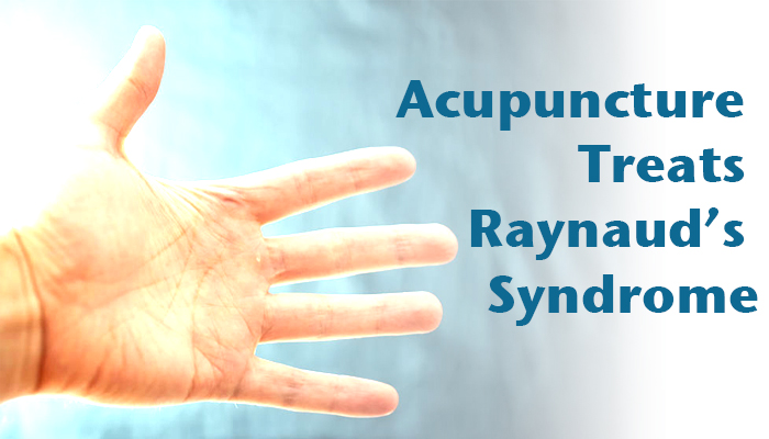 Acupuncture treats Raynaud's disease.