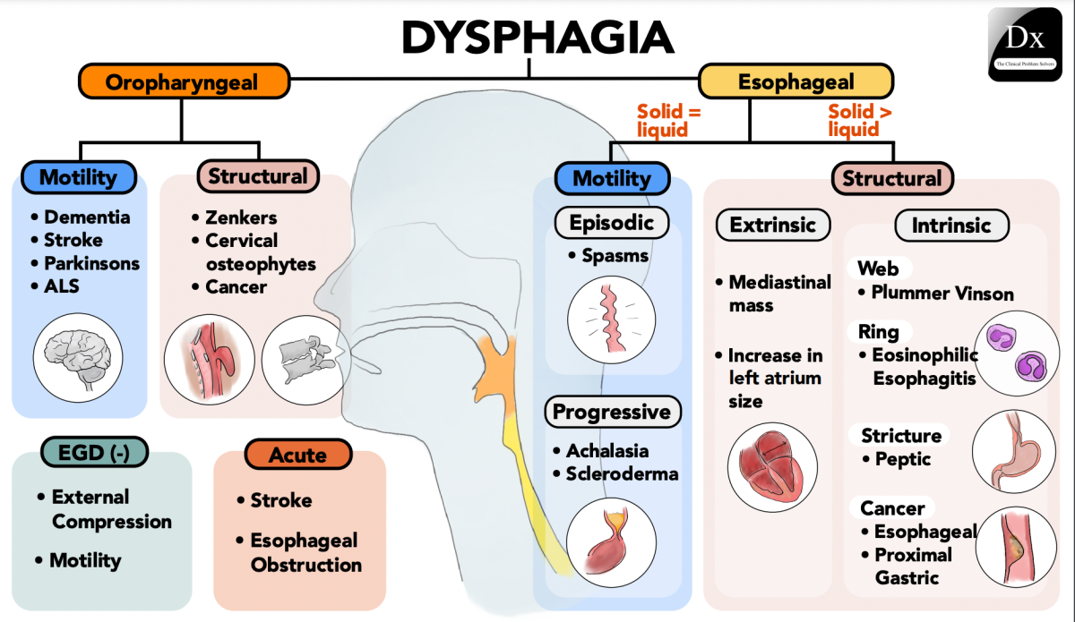 Difficulty swallowing