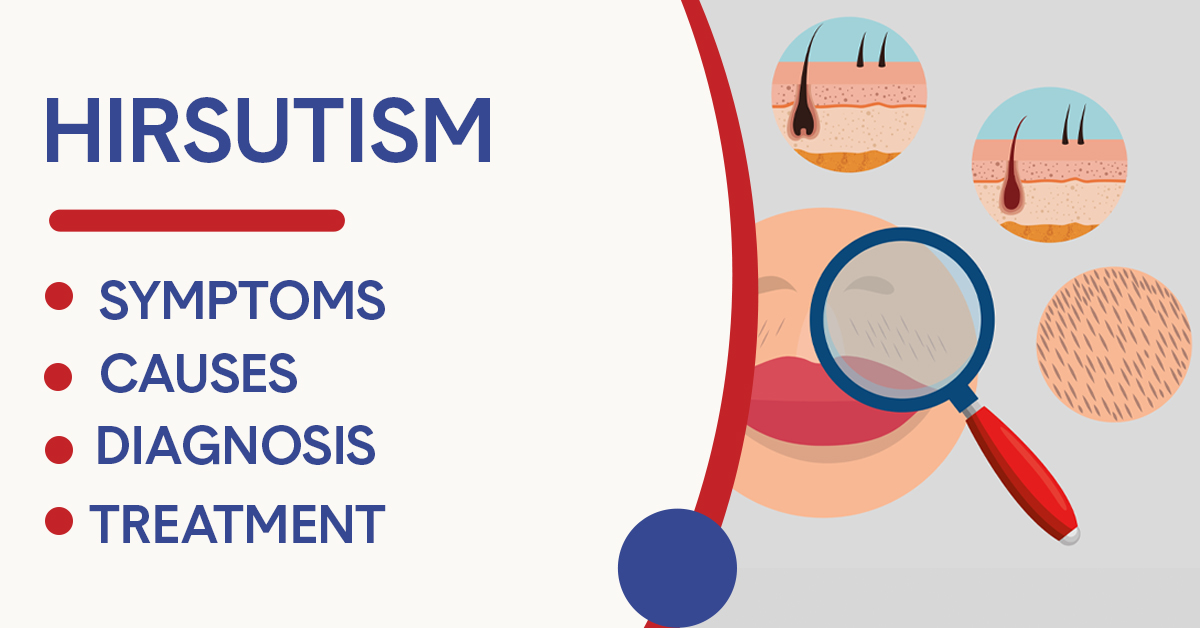 Hirsutism causes diagnosis and treatments