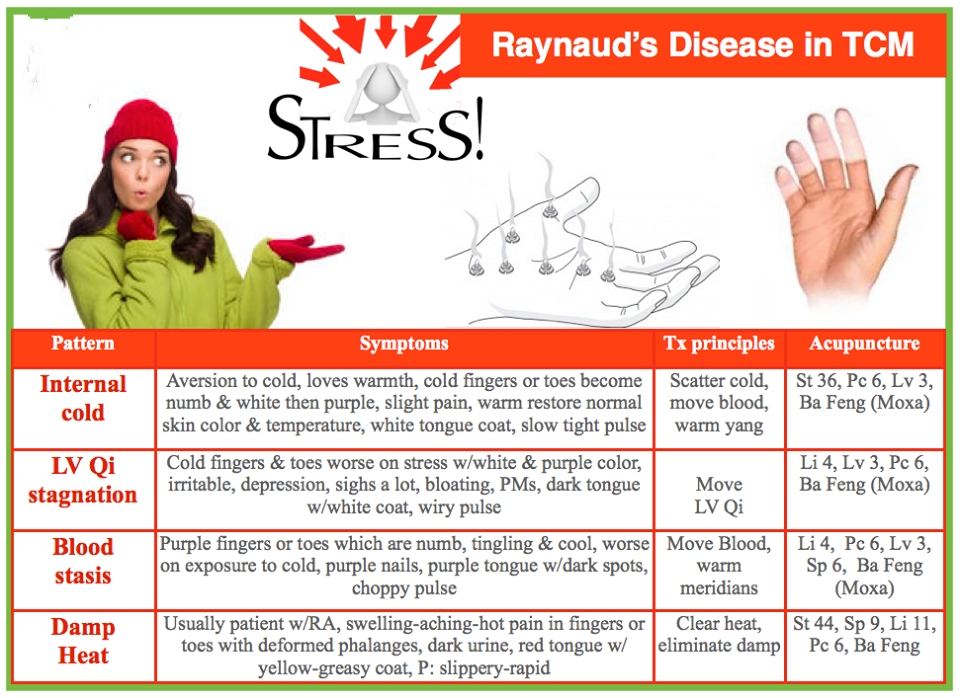 CM and Raynold's Disease