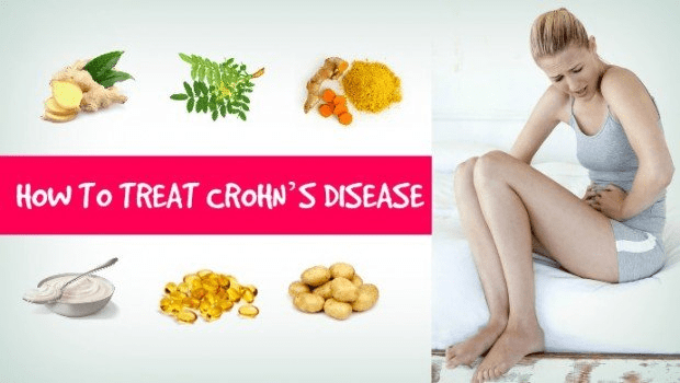 Crohn's disease natural treatments 2