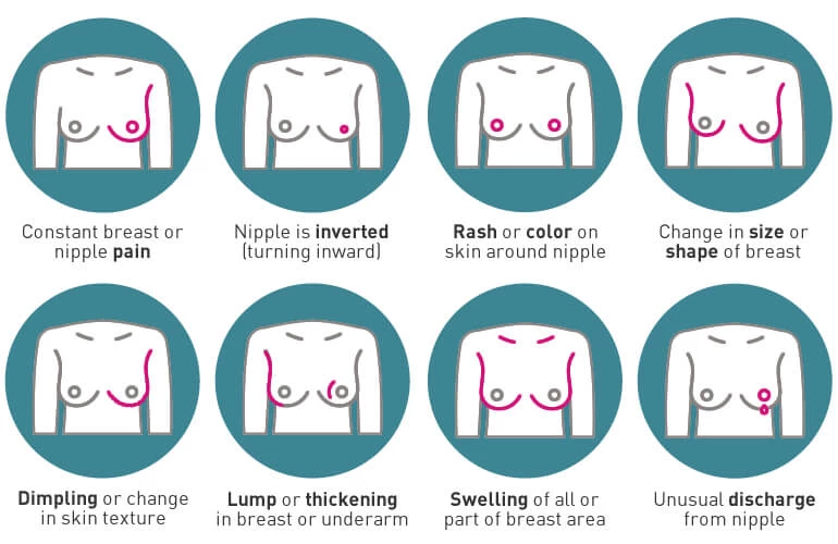 breast cancer signs and ymptoms