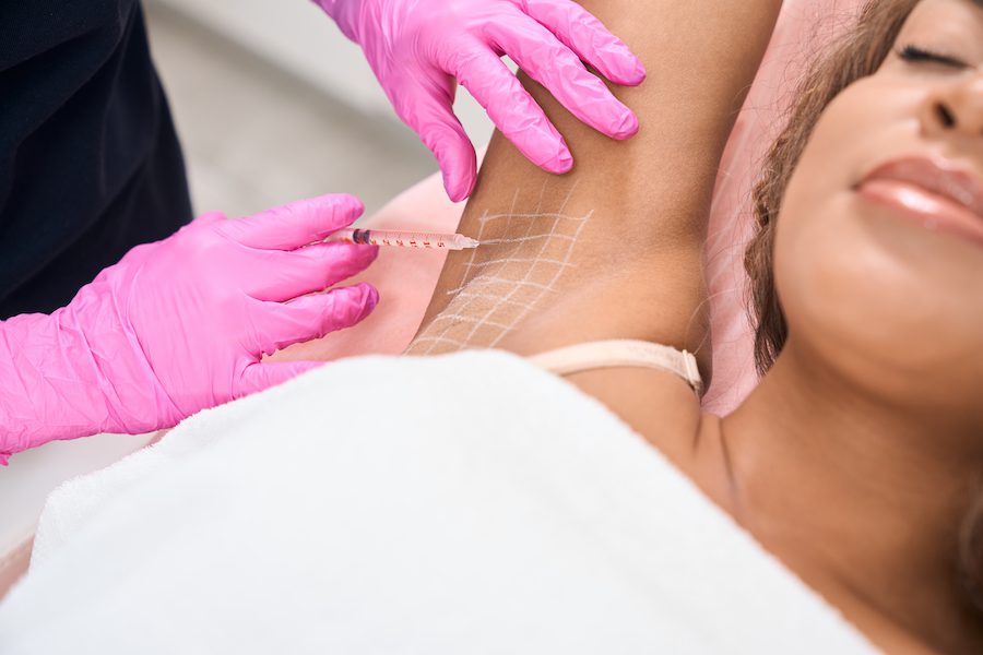 Botox injection for excessive sweating
