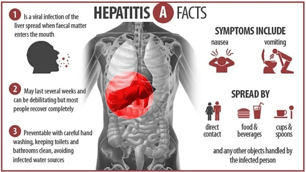 Hepatitis A