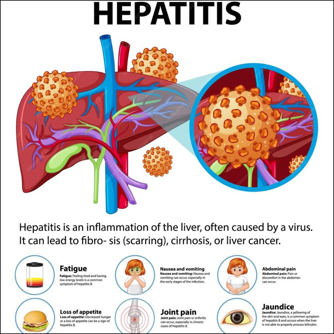 Hepatitis