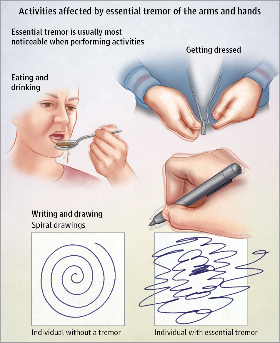 Activities affected
