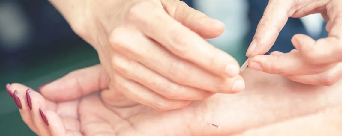 Acupuncture for paresthesia disease