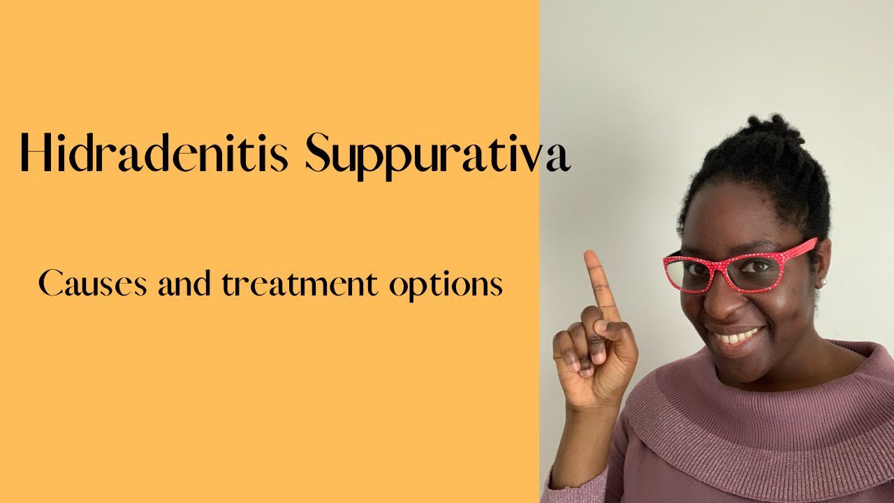 Hidradenitis Suppurativa, Causes and treatment options