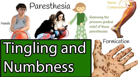 Paresthesia