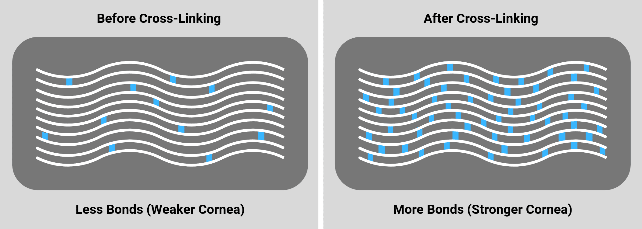 Cross Linking Treatment