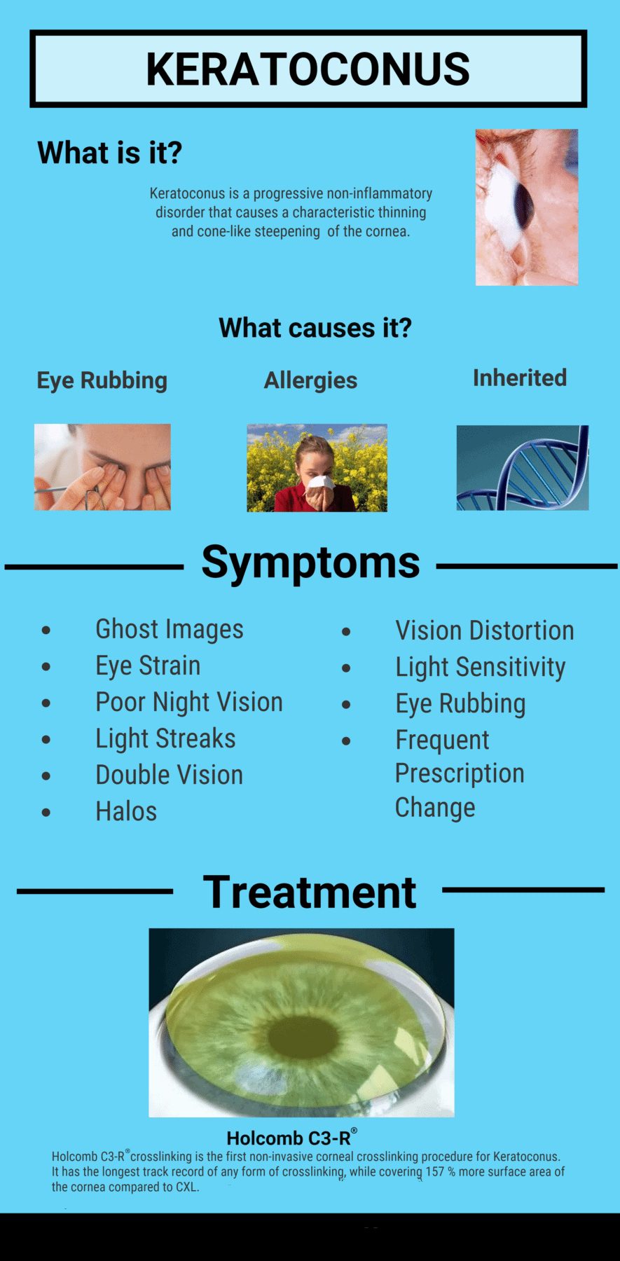 Keratoconus: causes, symptoms, and treatments
