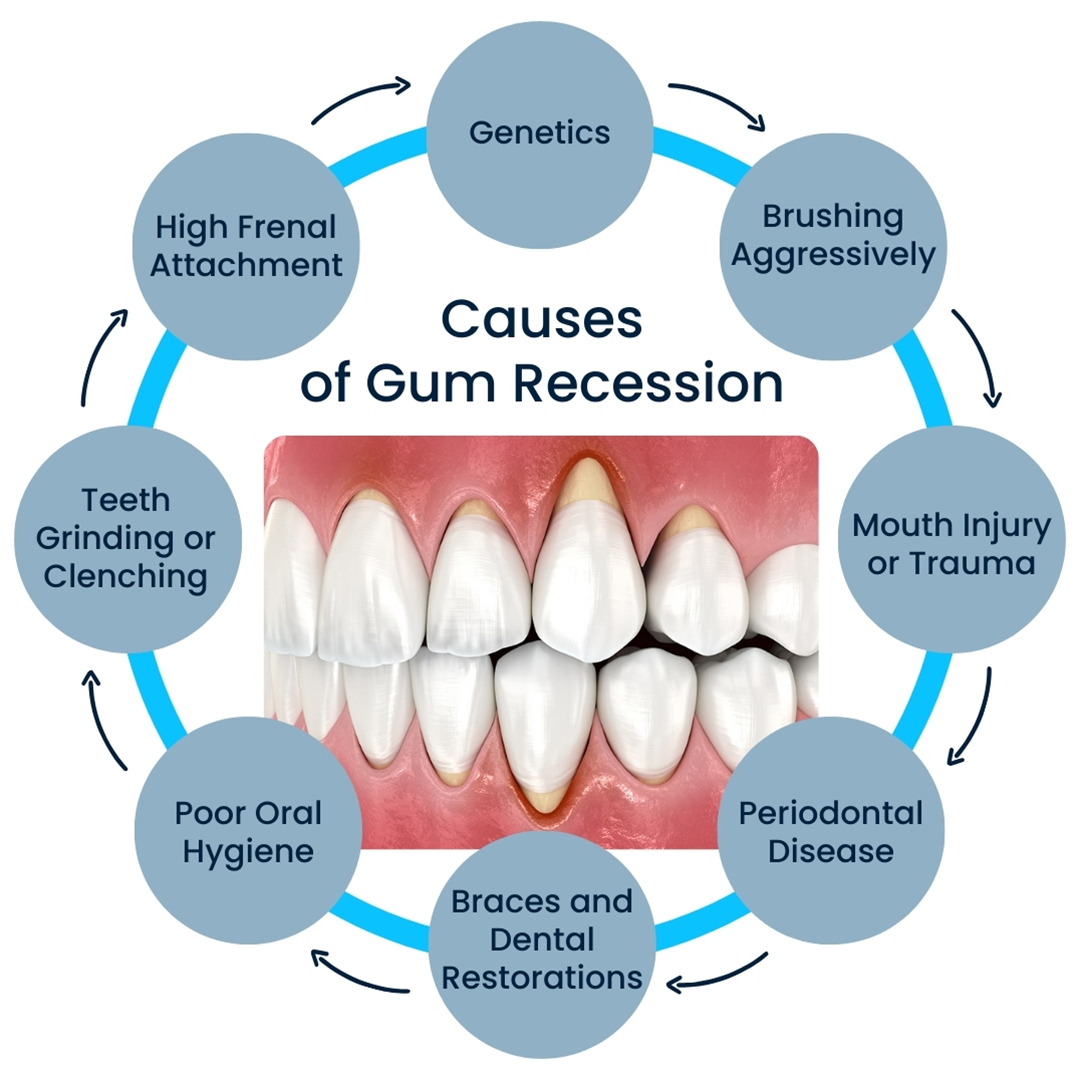 causes of gum resession