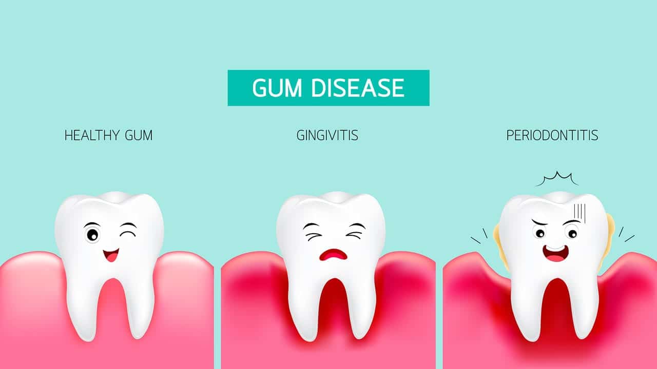 gum diseases