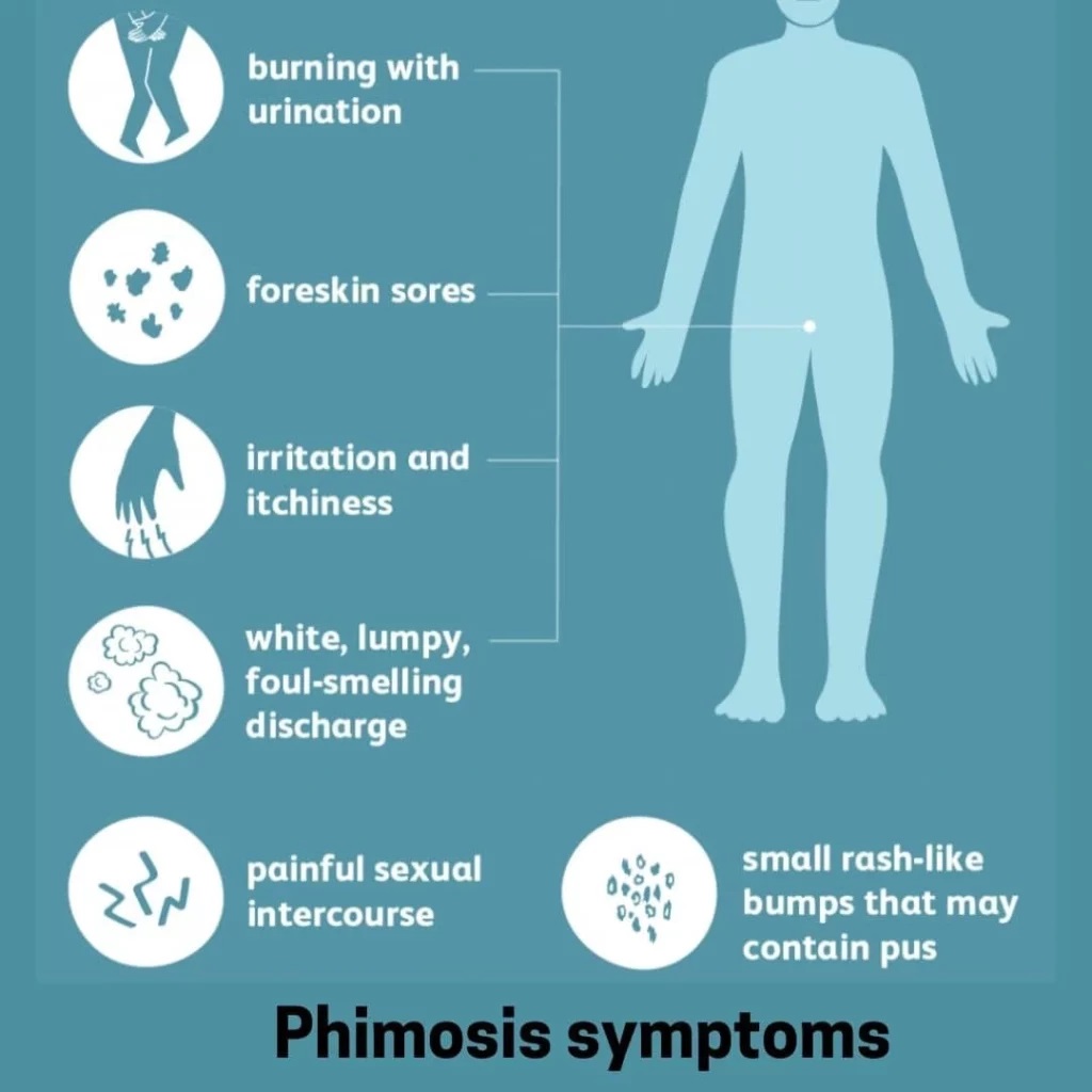 Symptoms of phimosis