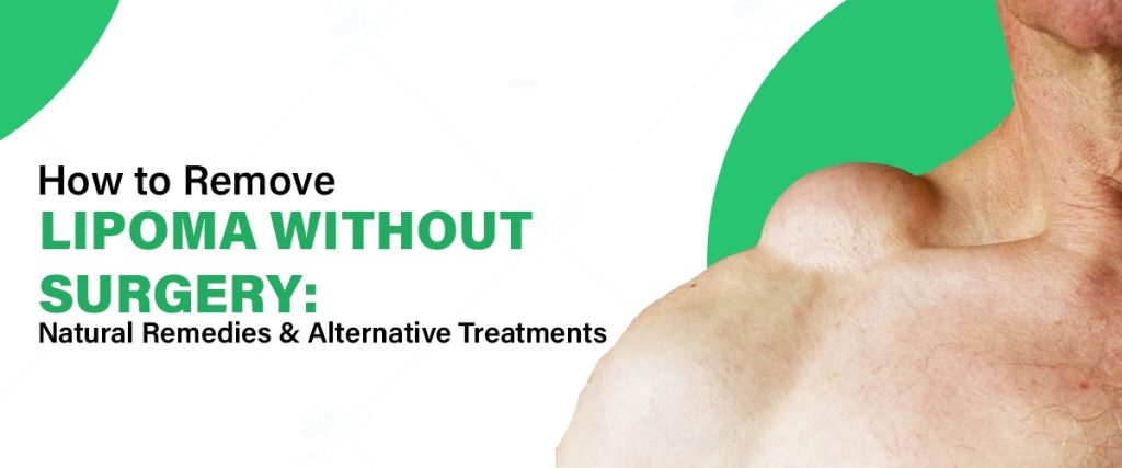 Natural treatment for lipomas