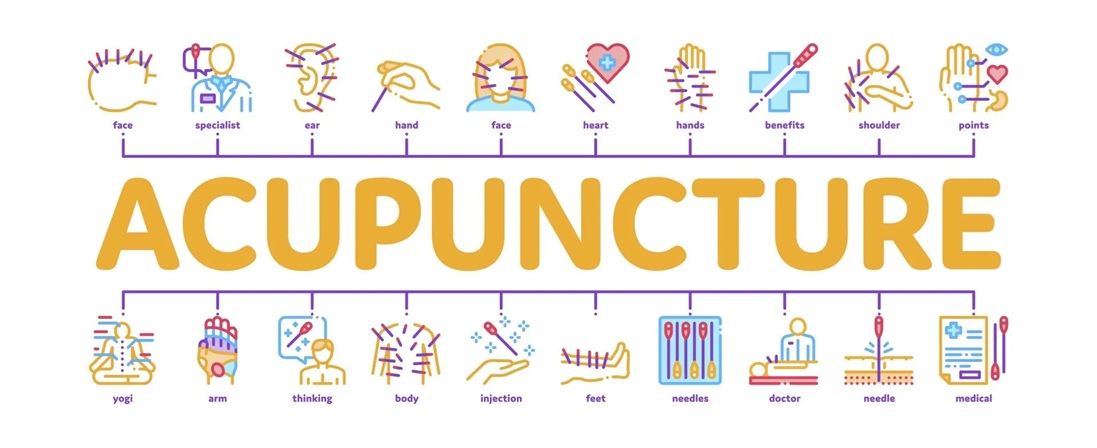Acupuncture