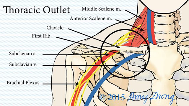 Mechanism of Thoracic Outlet Syndrome
