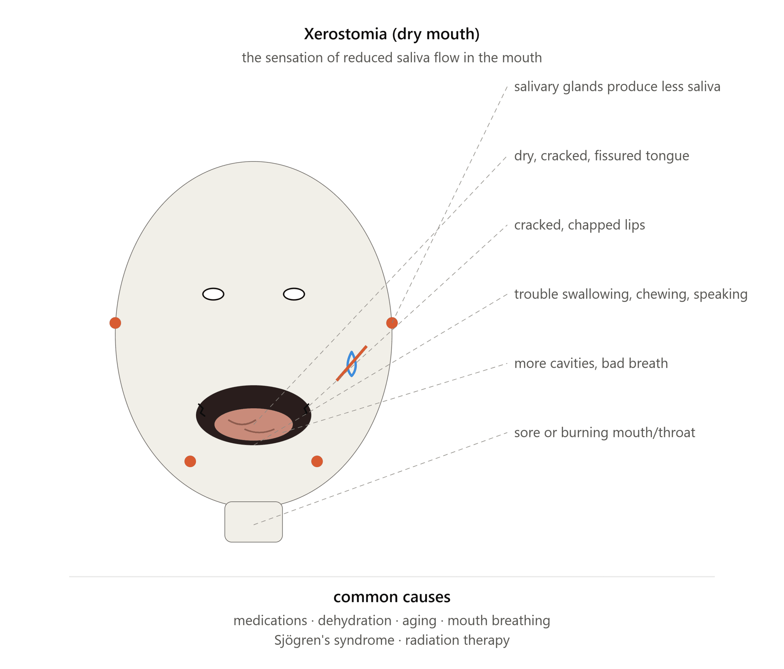 What is xerostomia (dry mouth)