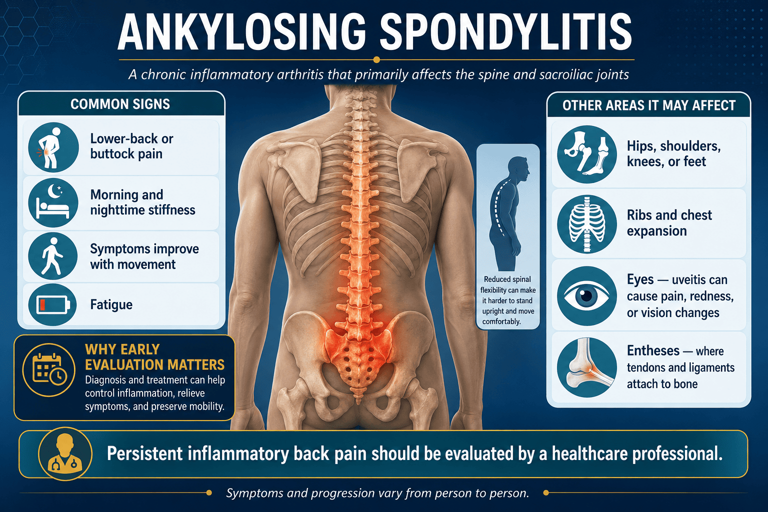 Ankylosing Spondylitis