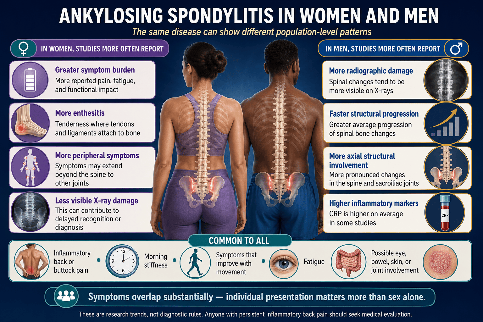 Difference of manifestation of Ankylosing Spondylitis in women and men